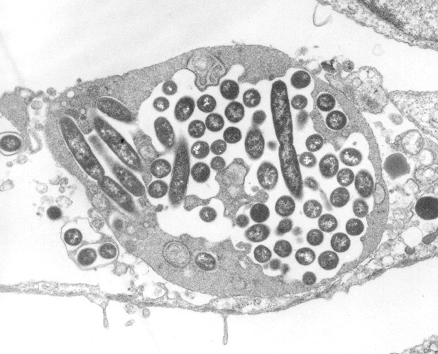 legionellapneumophila.jpg