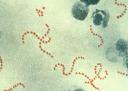 streptococcus_pyogenes.jpg