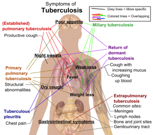 Tuberculosis_symptoms