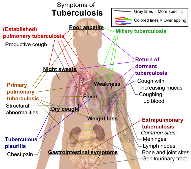 March 24 Marks World Tuberculosis Day | Novosanis