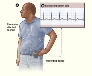 Holter_monitor_NIH