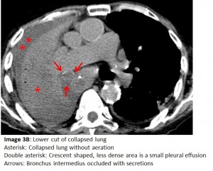 Image 3B Answer MQ 9 2016