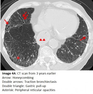 Image 4A Answer MQ 9 2016