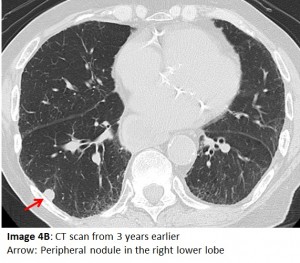 Image 4B Answer MQ 9 2016