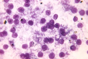 Pneumocystis_carinii._Toluidine_blue_stain_PHIL_596_lores