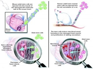 Stemcellheartrepair