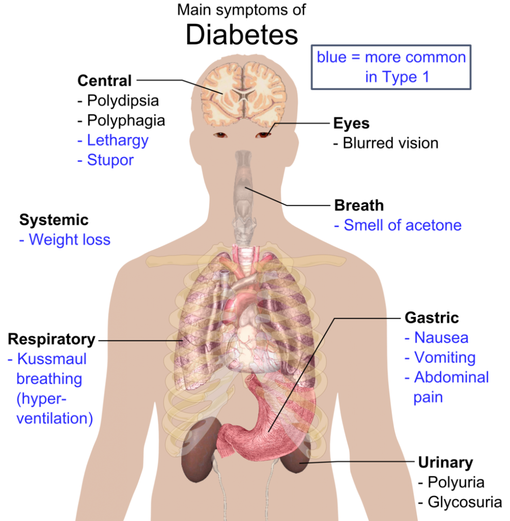 Insulin in a Pill Barriers to Development of Oral Insulin Clinical